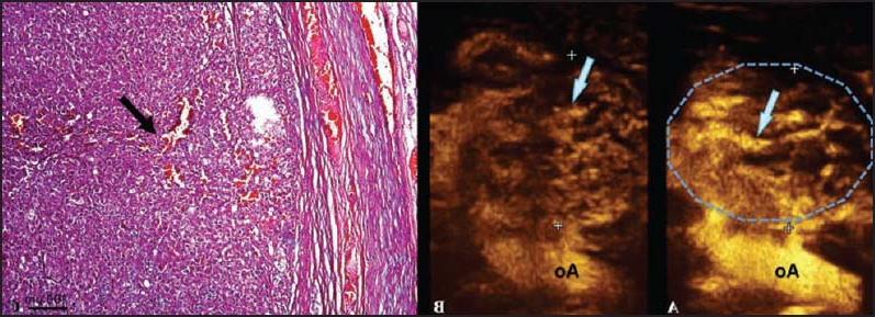 Adrenal Gland Cancer in Dogs Image 9