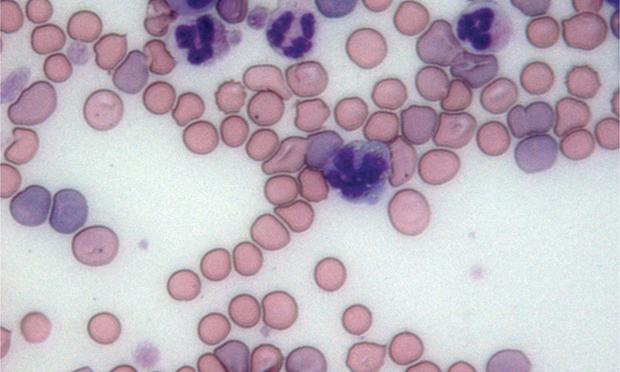 Autoimmune Hemolytic Anemia in Dogs Image 15