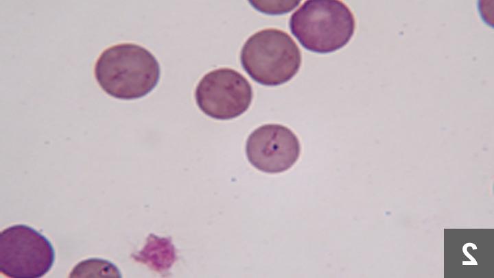 Babesiosis in Dogs Image 19