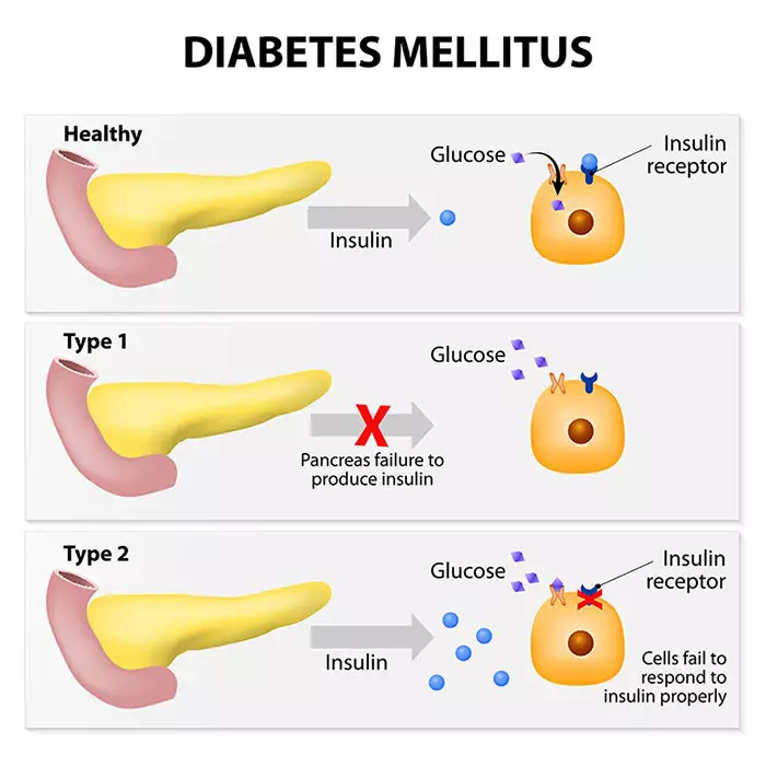 Diabetes Mellitus in Dogs Image 1