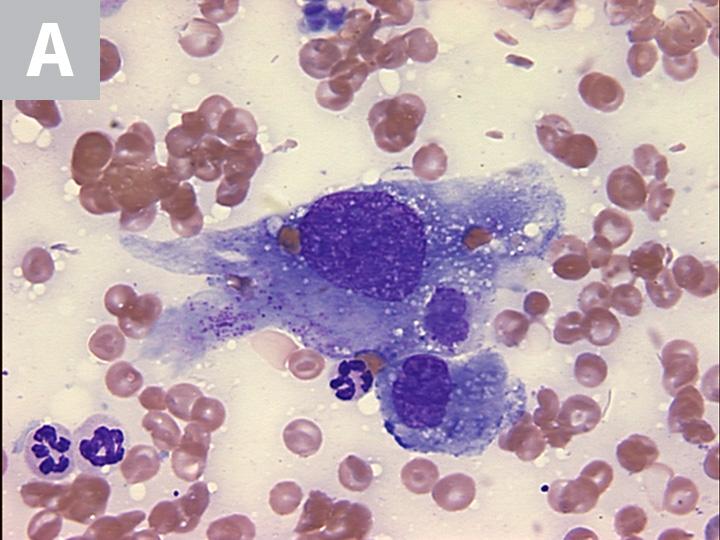 Hemangiosarcoma Image 6