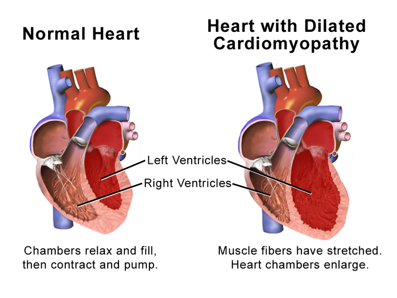 Hypertrophic Cardiomyopathy in Dogs Image 2