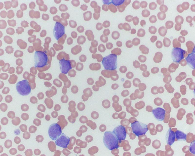 Leukemia in Dogs Image 2