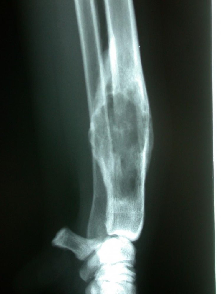 Osteosarcoma in Dogs Image 13