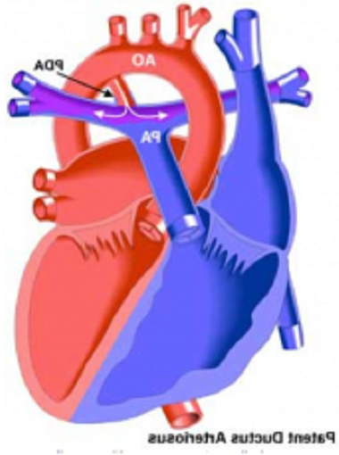 Patent Ductus Arteriosus in Dogs Image 4