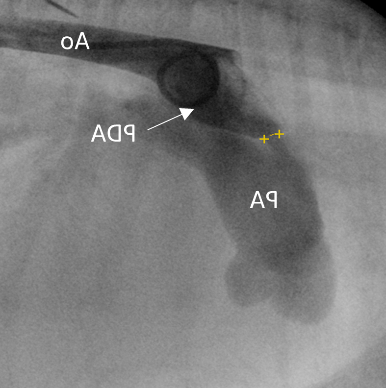 Patent Ductus Arteriosus in Dogs Image 7