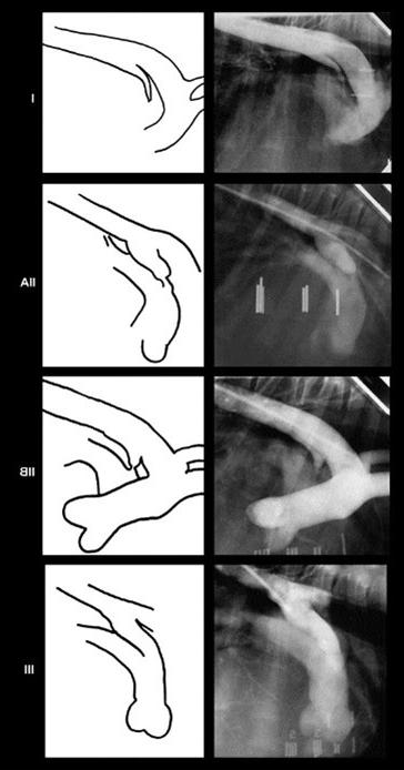 Patent Ductus Arteriosus in Dogs Image 9