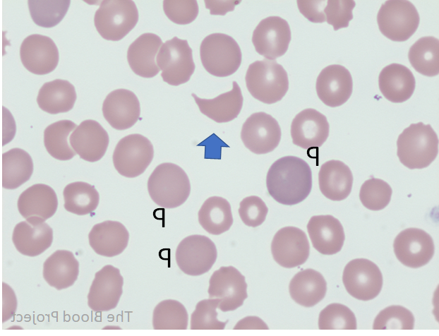 Polycythemia in Dogs Image 17