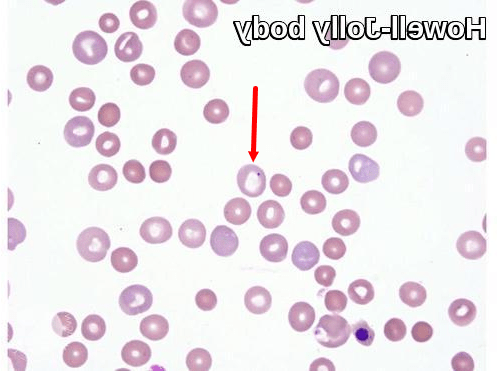 Polycythemia in Dogs Image 20