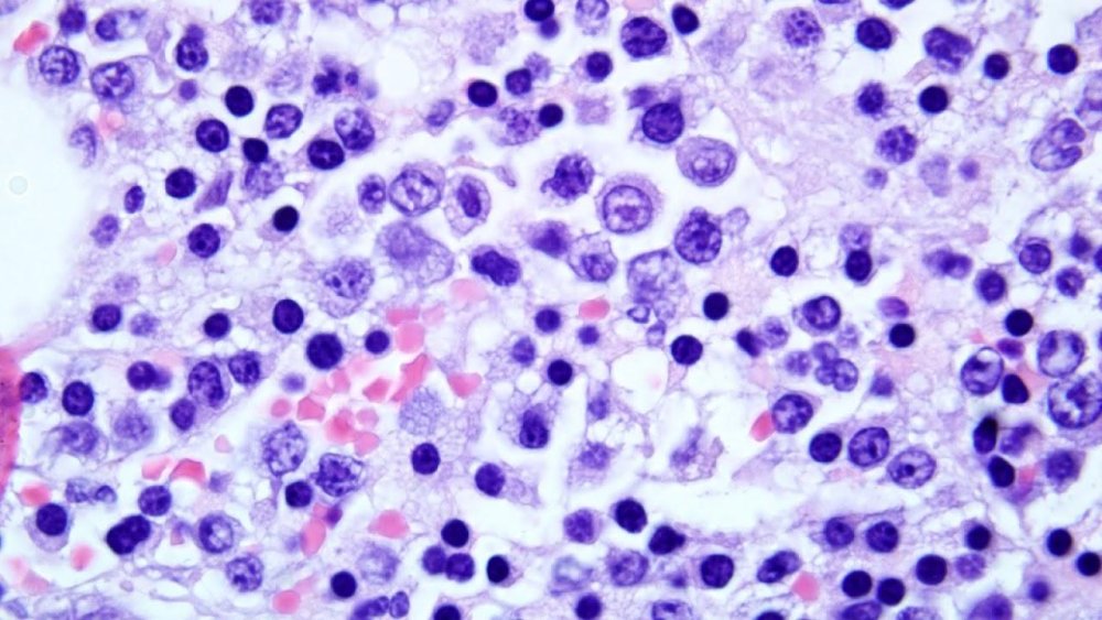 Polycythemia in Dogs Image 7